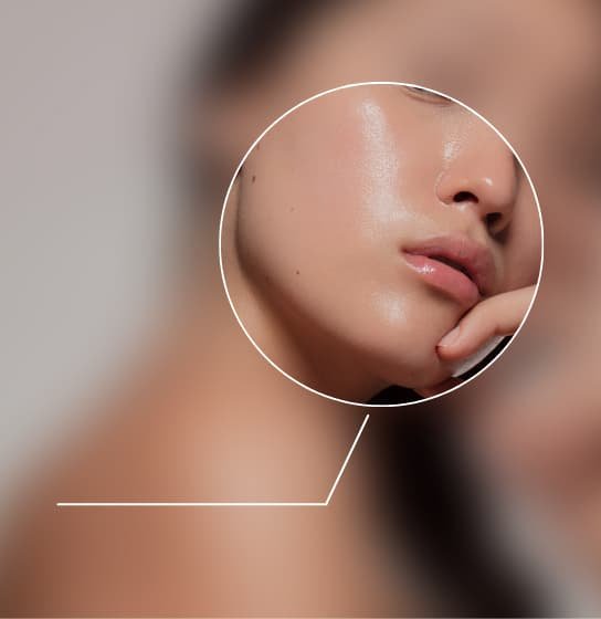 Primer plano de piel con poros visibles y brillo — limpieza facial profunda con extracciones seguras en Houston